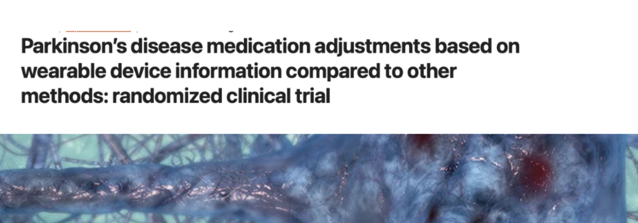 STAT-ON® in Nature npj Parkinson’s Disease: A Milestone for Real-World Clinical Evidence